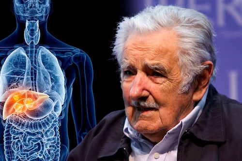 ¿Qué tipo de cáncer tiene el expresidente José Mujica? Médica anuncia su estado de salud