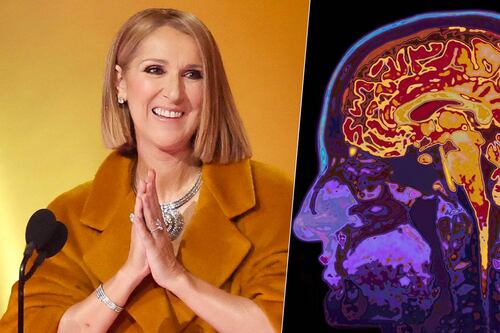Celine Dion aparece en los Grammy 2024: ¿Qué es el síndrome de la persona rígida, su rara enfermedad?