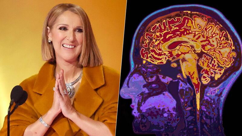 Celine Dion aparece en los Grammy 2024: ¿Qué es el síndrome de la persona rígida, su rara enfermedad?