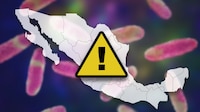 Bacteria Klebsiella oxytoca se ‘propaga’ en México: ¿Qué estados registran casos? Esto reveló Salud