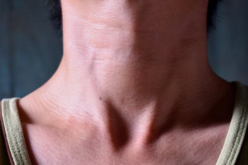 ¿Por qué el hipotiroidismo afecta tanto a las mujeres?