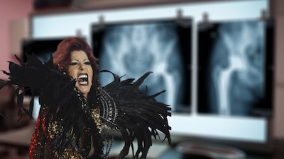 Alejandra Guzmán tuvo un accidente que causó problemas en la cadera. (Foto: Cuartoscuro/IaGemini)