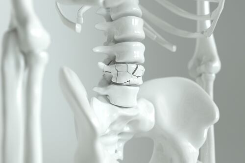 Llegar a la vejez significa cuidar tus huesos: ¿Cómo prevenir y detectar la osteoporosis?