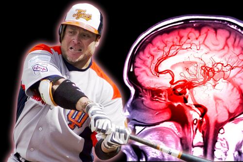 Karim García sufre una embolia: ¿Qué es este padecimiento y por qué ocurre?