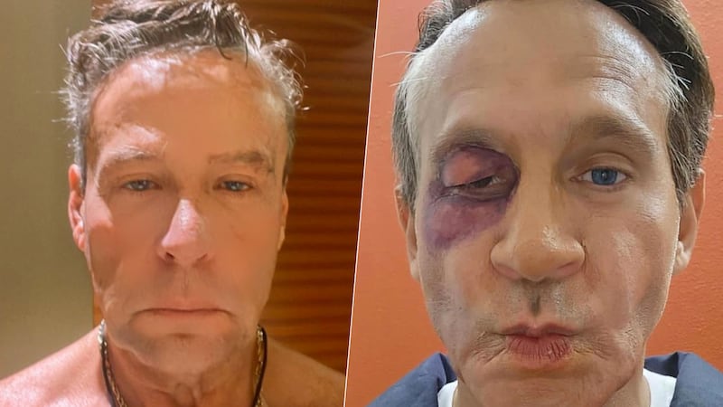 Alfredo Adame reacciona a parodia de Arath de la Torre sobre sus golpes