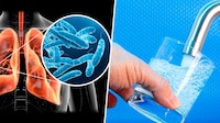 Legionella: La bacteria detrás de casos de neumonía en Argentina que puede estar en tu lavabo