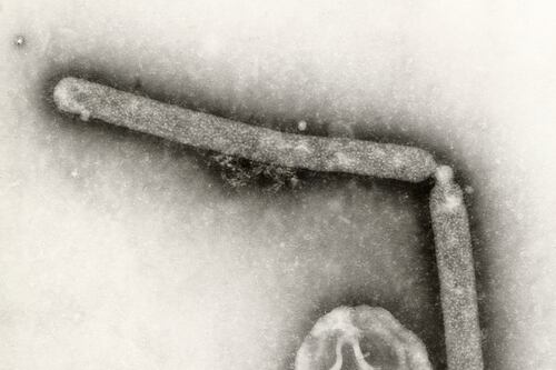 No te queremos asustar, pero... CDC detecta mutación del virus de la gripe aviar en paciente en EU