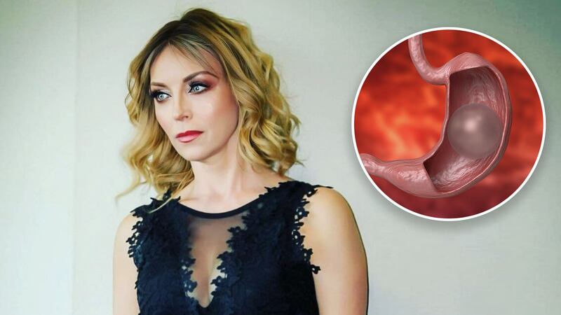 Retiran balón gástrico a hijo de Laura Flores: ¿Qué es y cómo funciona?