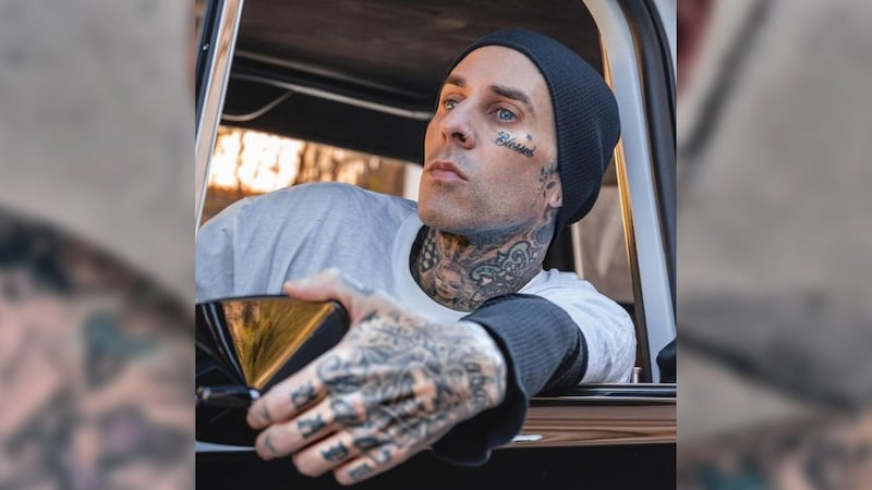 Travis Barker, baterista de Blink-182, comparte fotos tras operación: ‘Era inevitable’