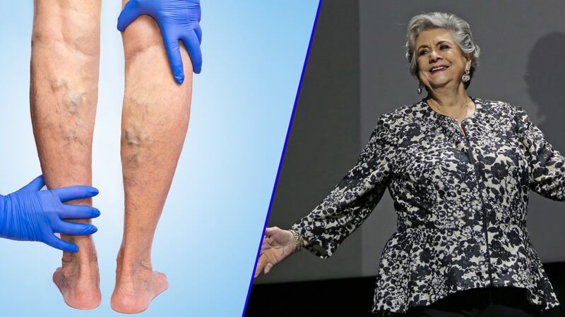 Queta Lavat fue operada para tratar trombosis: ‘Ha sido algo muy pesado’, dijo