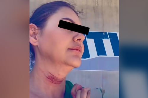 Mujer se quita la vida tras cirugía mal realizada en Tijuana