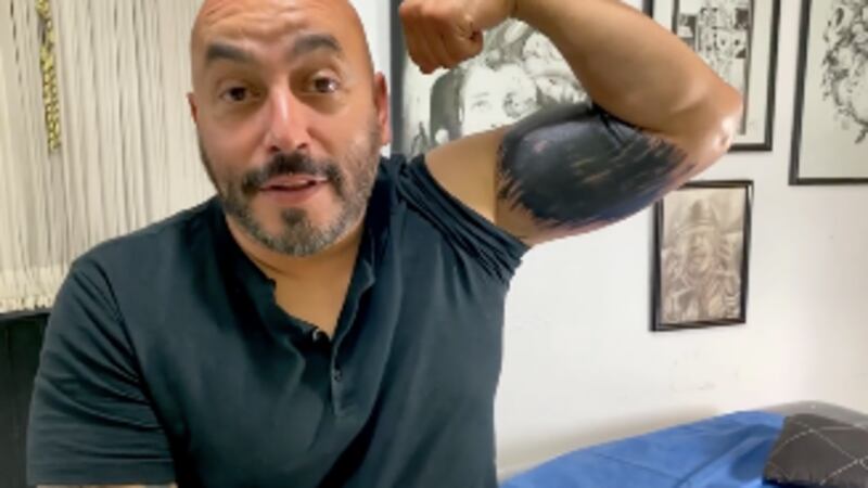 Lupillo Rivera comparte proceso con el que borró su tatuaje del rostro de Belinda