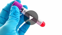 Una persona muere por hantavirus y se encienden las alarmas en China