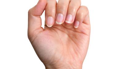 ¿Notas tus uñas de otro color o diferentes? Puede ser síntoma de COVID